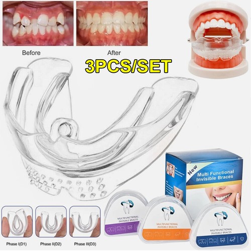 Stage dental orthodontic - 3,