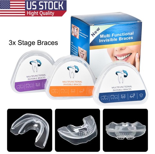 Stage adult teeth aligners - adult,